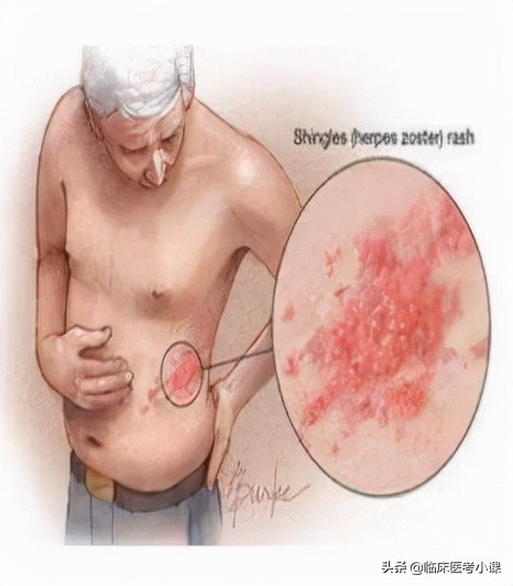 胸痛者常见检查项目,心跳疼痛胸痛是什么症状