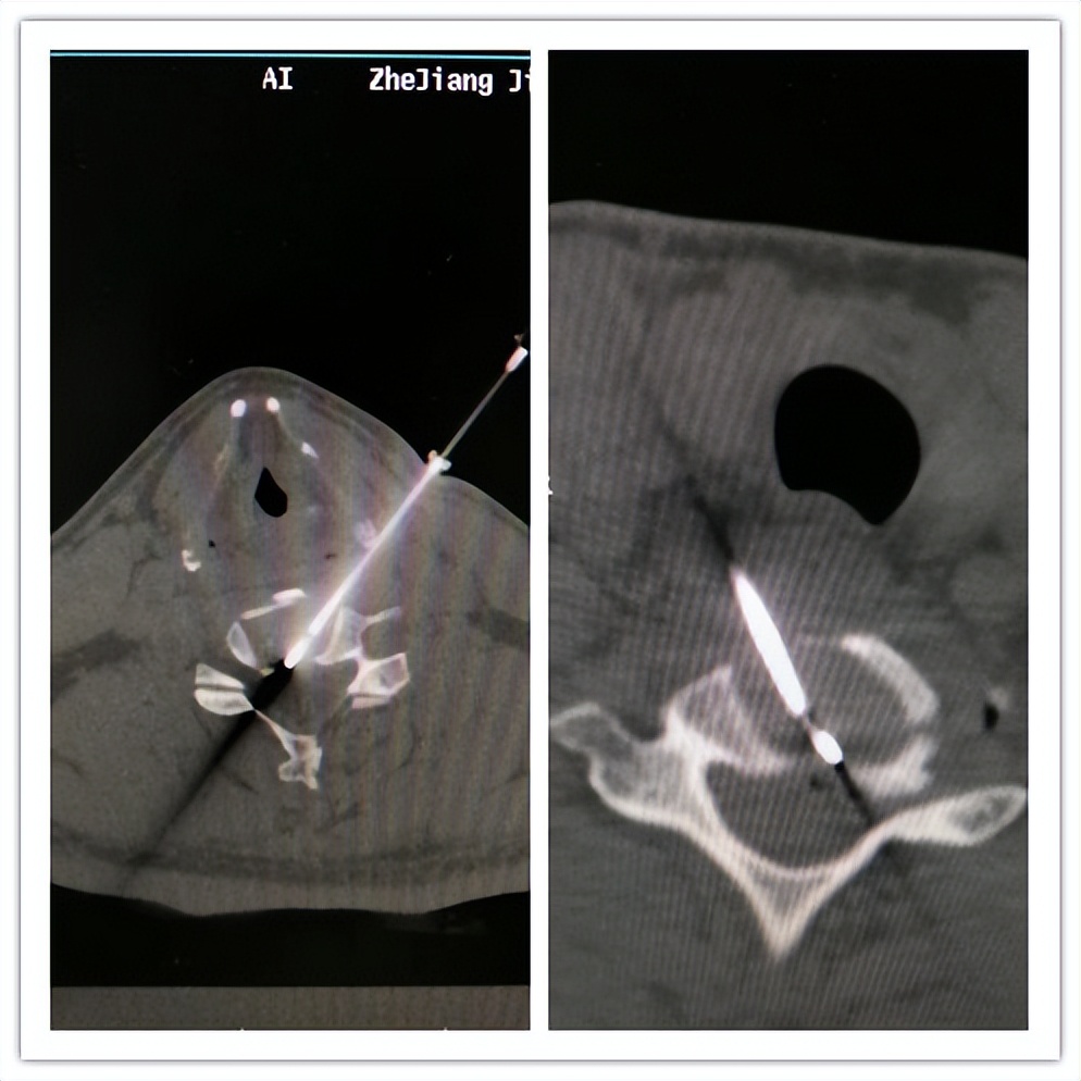 嘉善人民医院疼痛科专家,嘉善第一人民医院中医内科