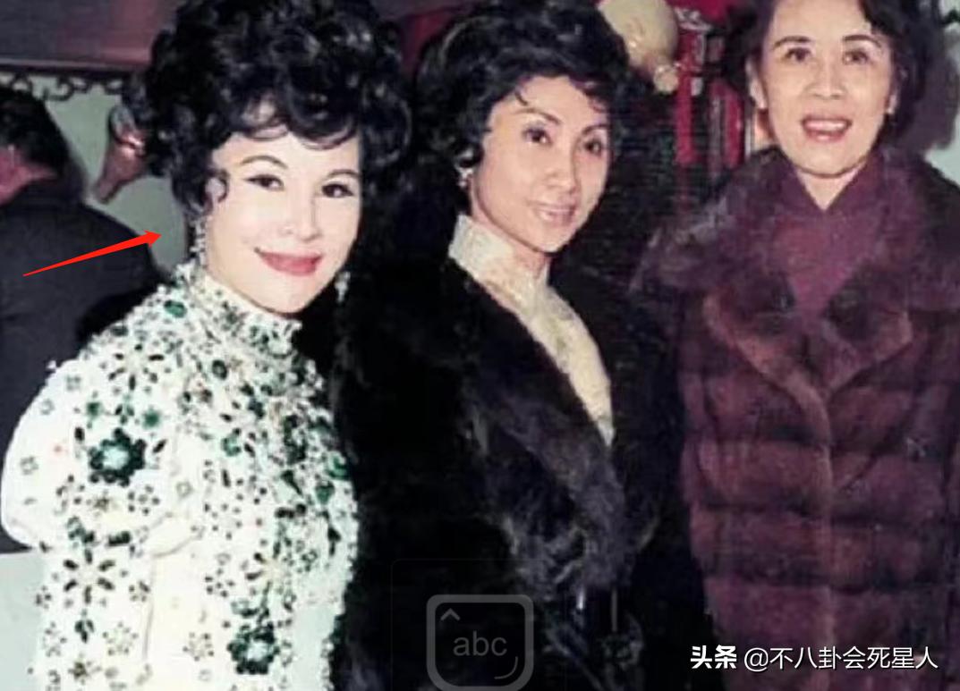 哪个女明星整容脸部变僵硬,整容脸vs自然脸的明星老去