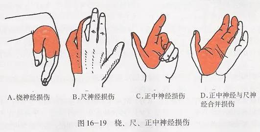 手冷手麻是什么原因,突然手麻手僵是什么原因引起的