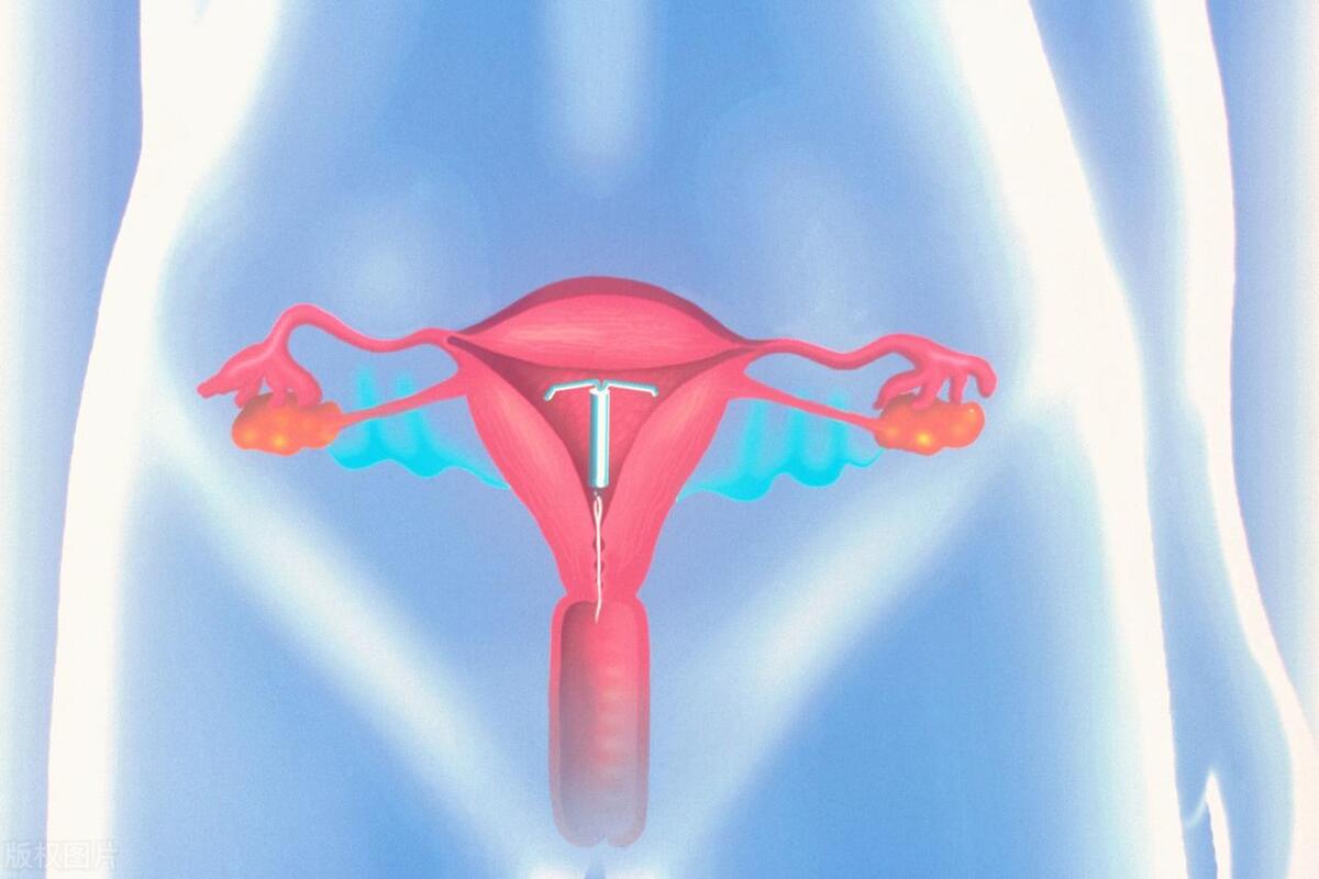 女人切除子宫后会有哪些不适,女性切除子宫之后会有什么影响