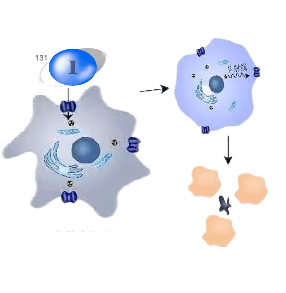 甲状腺术后需要忌碘吗,甲状腺术后忌碘