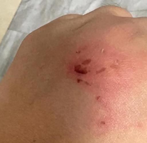 自述牵狗进电梯道歉,女生在电梯牵狗被夫妇殴打后续