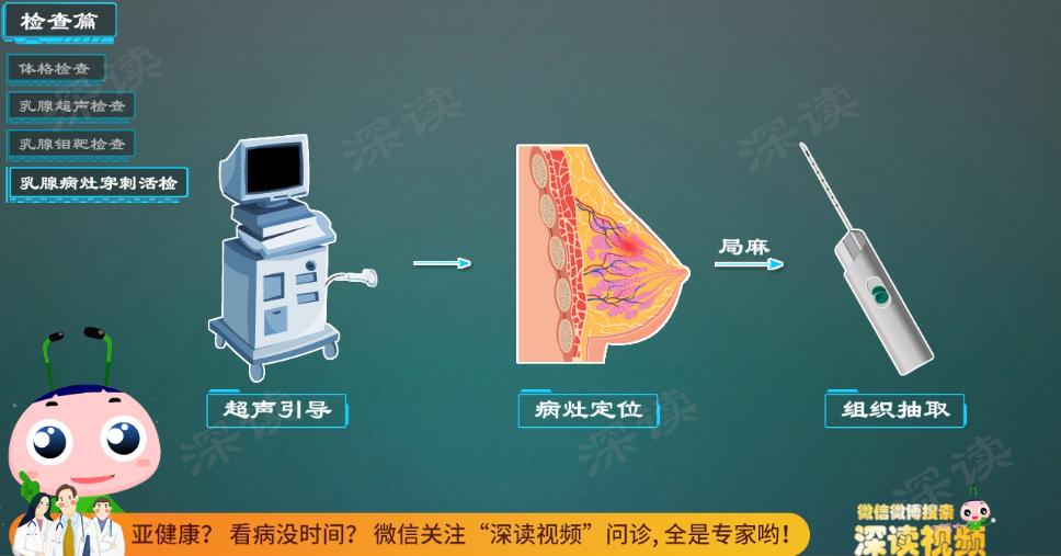 乳房有点增生怎么办,螺内酯副作用乳腺增生