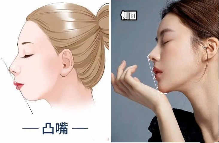 高级脸为什么看着显老,什么样的脸减龄