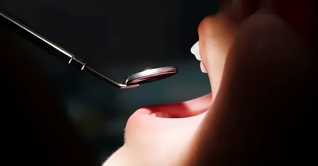 宁波种植牙医保试点医院,宁波公立医院种植牙集采