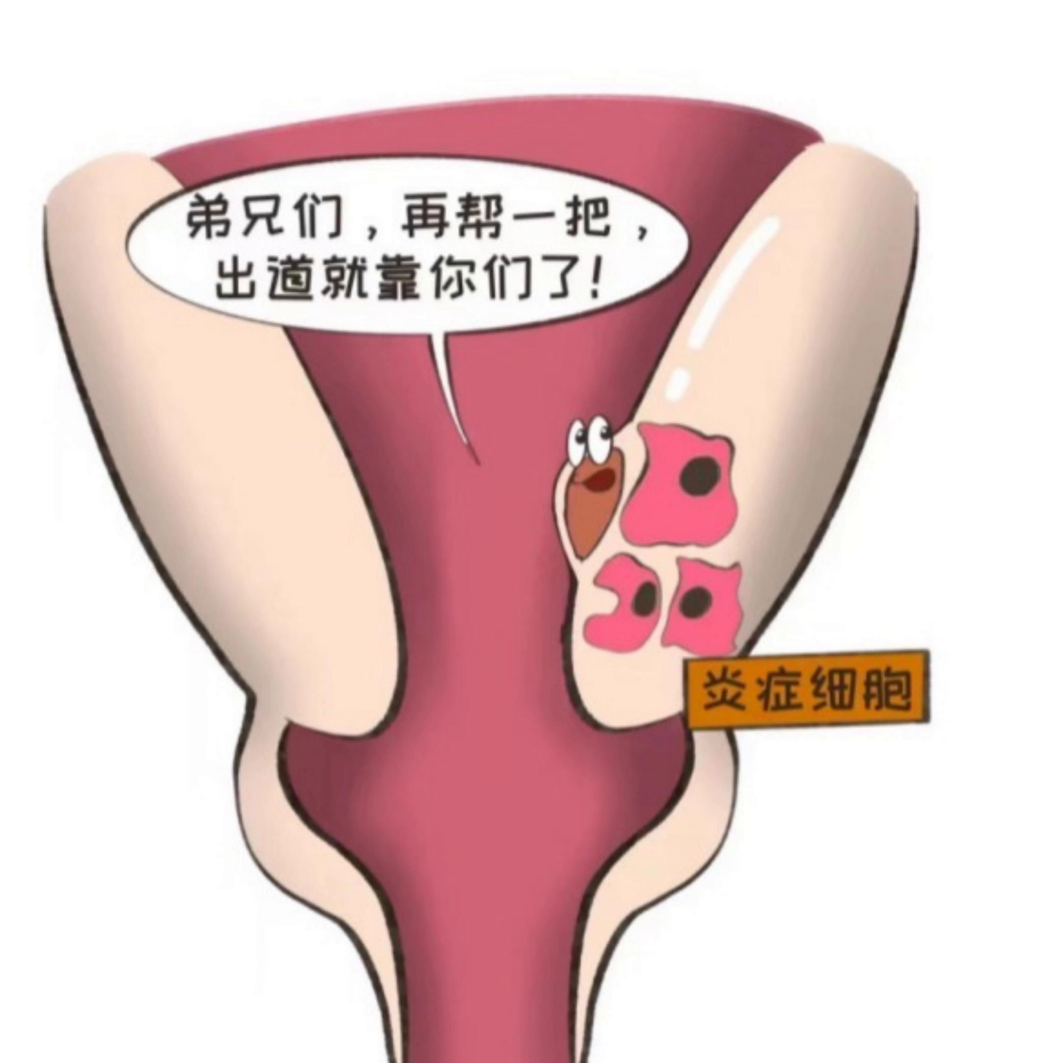 女性宫颈会长“小鲜肉”？来听听董医生怎么说,上#董...