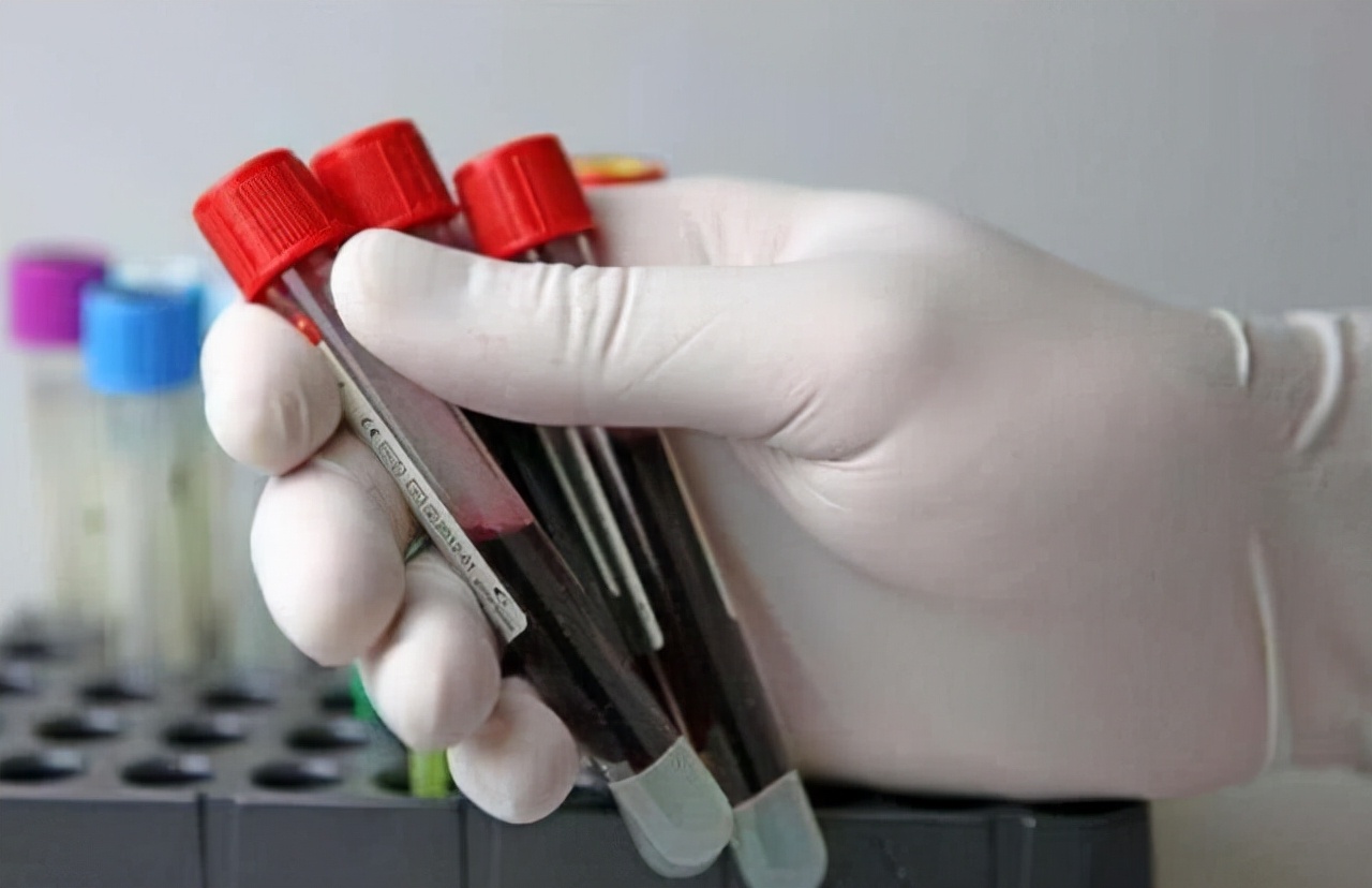 血常规中哪些指标升高需要再查,血常规四个指标升高需要注意什么