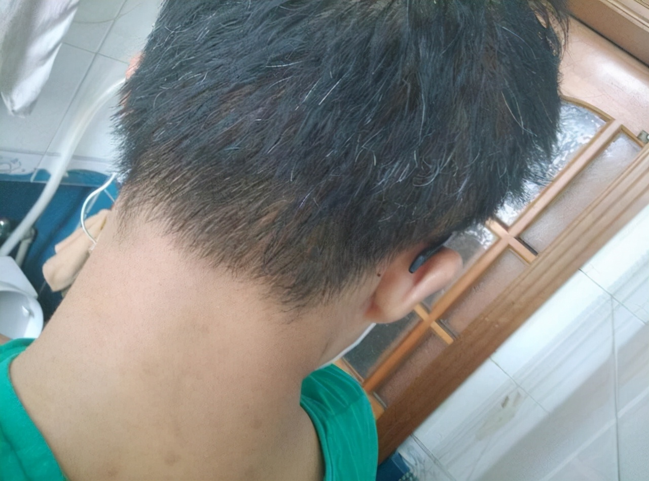 白发在头顶长代表什么,白发长在额前多是什么原因