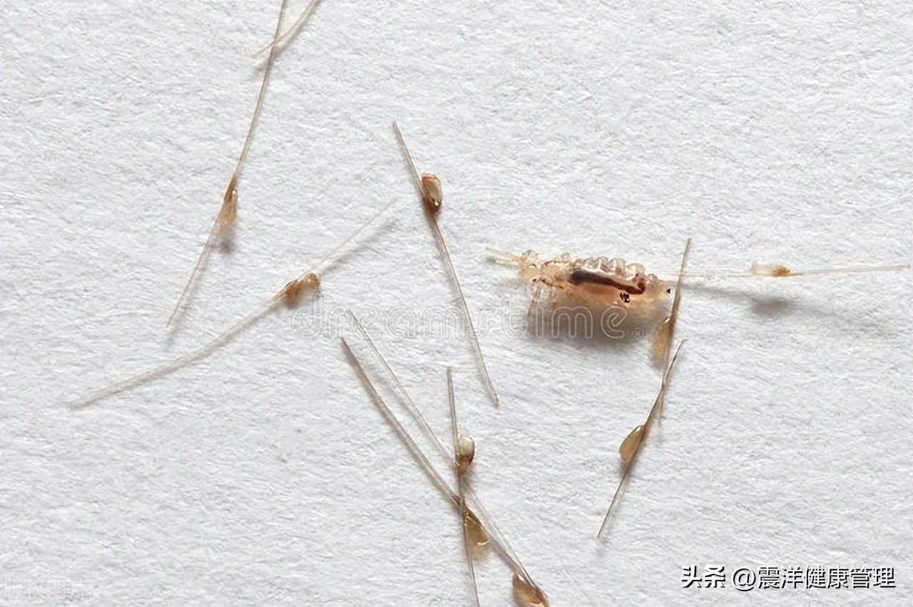 阴虱是什么原因发生的,阴虱是什么为什么会得阴虱