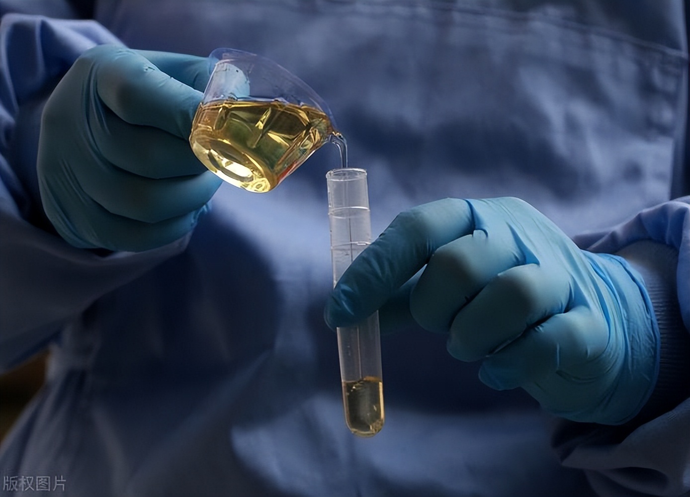 类风湿合并肝病怎么治疗,类风湿合并肾炎怎么治疗