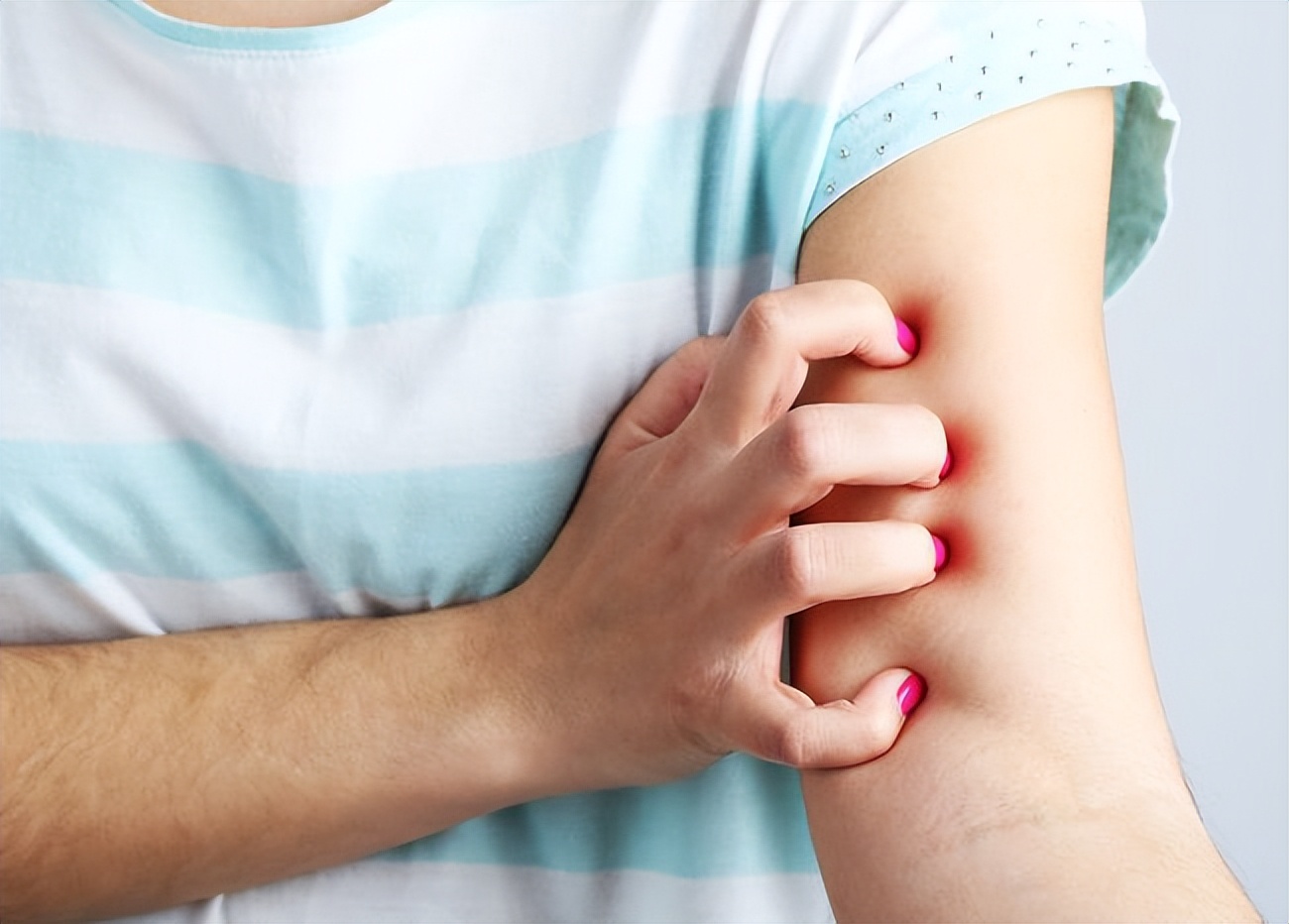 给所有女性提个醒,下巴周围一圈发痒跟hpv有关吗