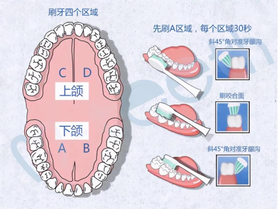 电动牙刷使用视频教程,如何正确使用电动牙刷刷牙