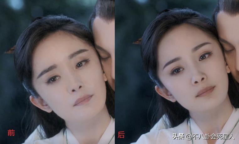 假双眼皮的明星,明星的假脸