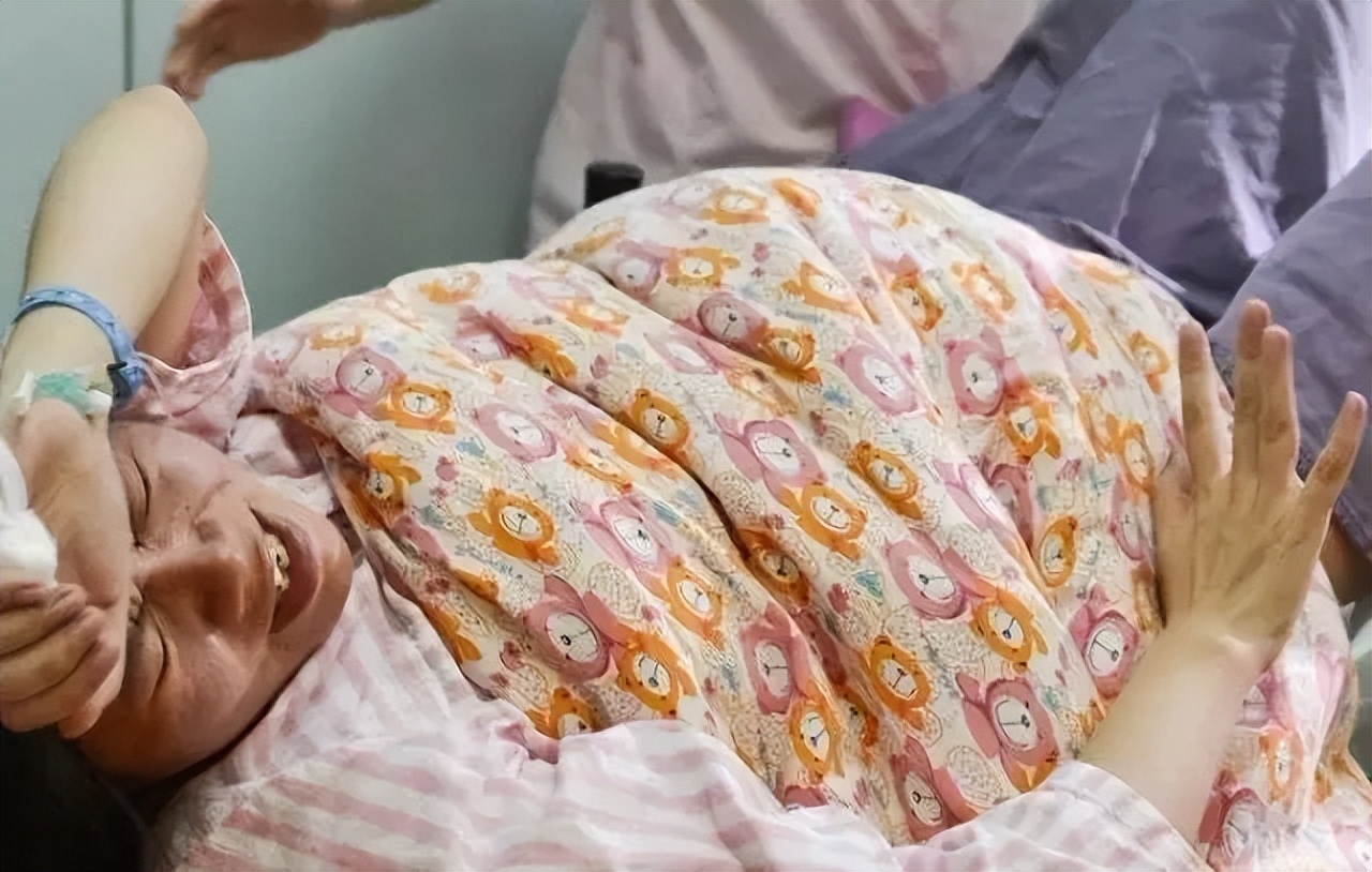 顺产开10指不顺利剖腹产注意什么,顺产开八指相当于几级疼痛