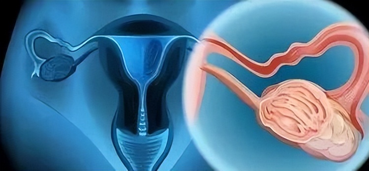 癌不传染但这4种癌要小心,癌症有没有可能传染后代