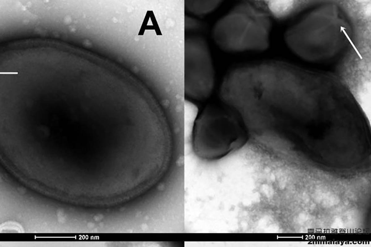 俄罗斯真的有僵尸病毒吗 (俄罗斯感染了僵尸病毒了吗)
