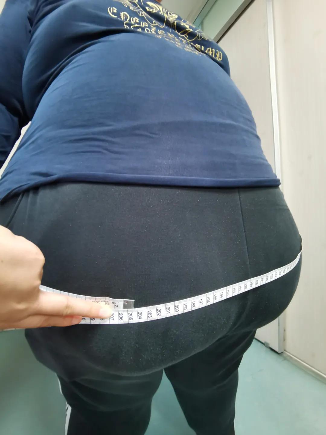 「案例」“广州巨臀”两年长胖两百斤？