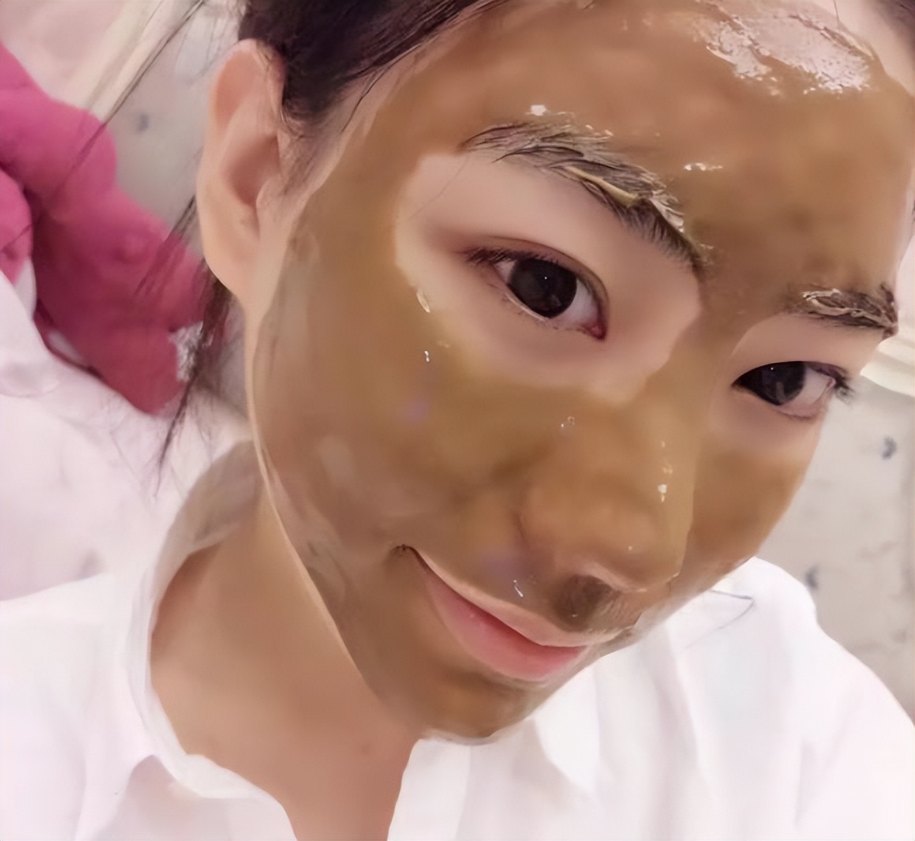 祛老年斑涂抹什么药膏有效,快速消除老年斑的小妙招红霉素