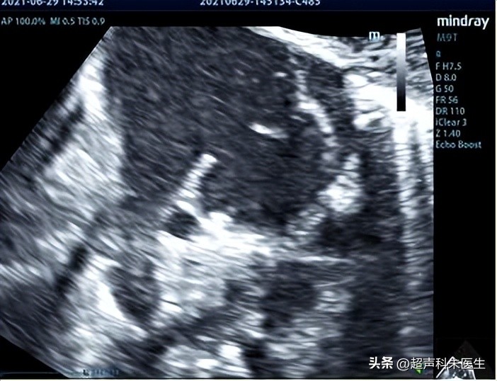 心眼多和心计是好事还是坏事,心眼多心不正