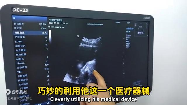 孔医生治疗前列腺炎,经尿道前列腺消融治疗步骤