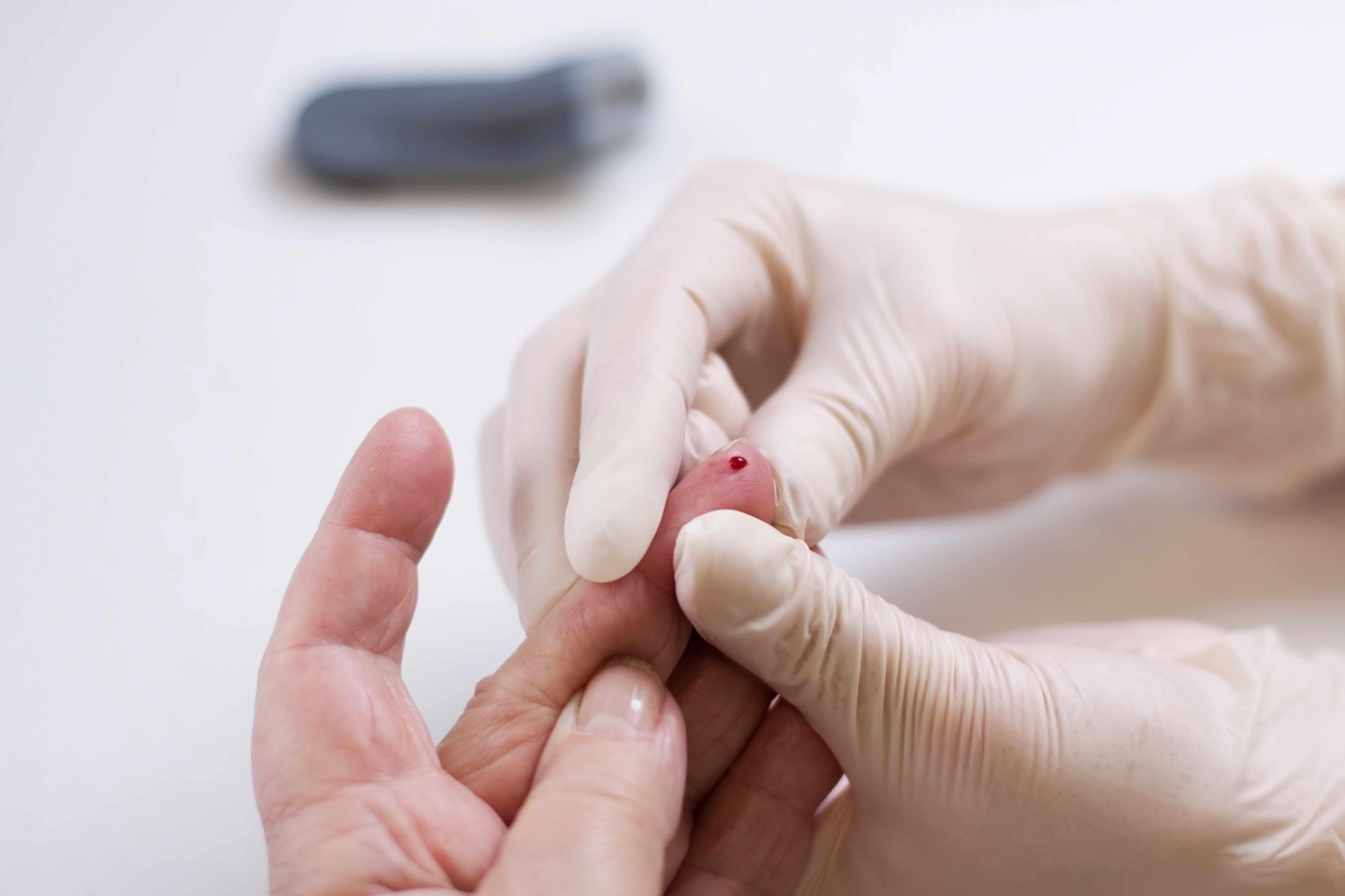 身体钙质流失快是什么原因,成人钙流失怎么补最快最好