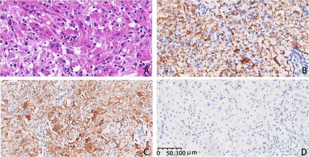 星闻丨领星携手中山一院金华伟教授团队探索中枢神经系统罗道病