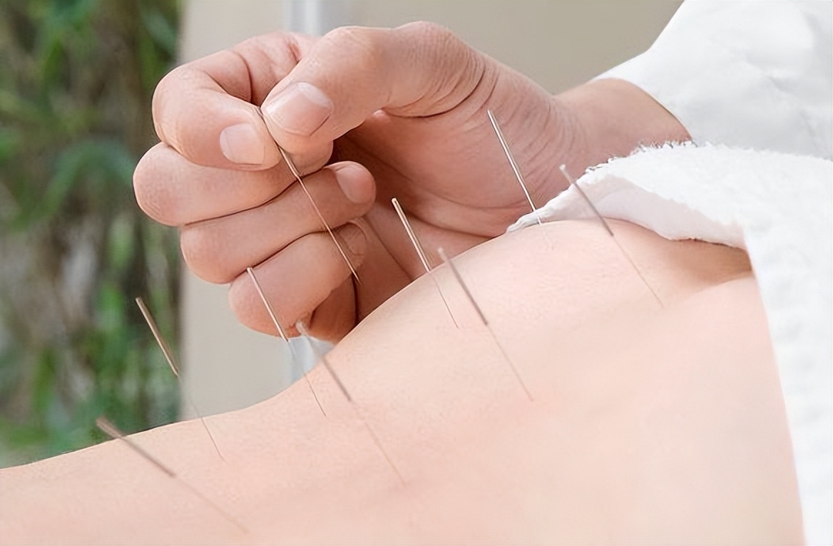 治腰椎间盘突出埋线得几天见效,腰椎间盘突出电针灸治疗的原理