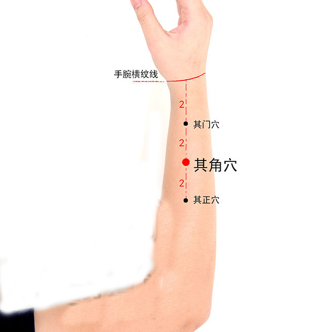 泌尿系疾病针灸,泌尿系统感染针灸哪里最有效