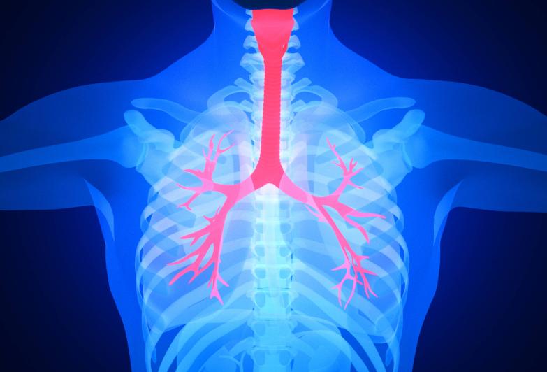 低氧血症常见的原因,低氧血症怎么治疗最有效