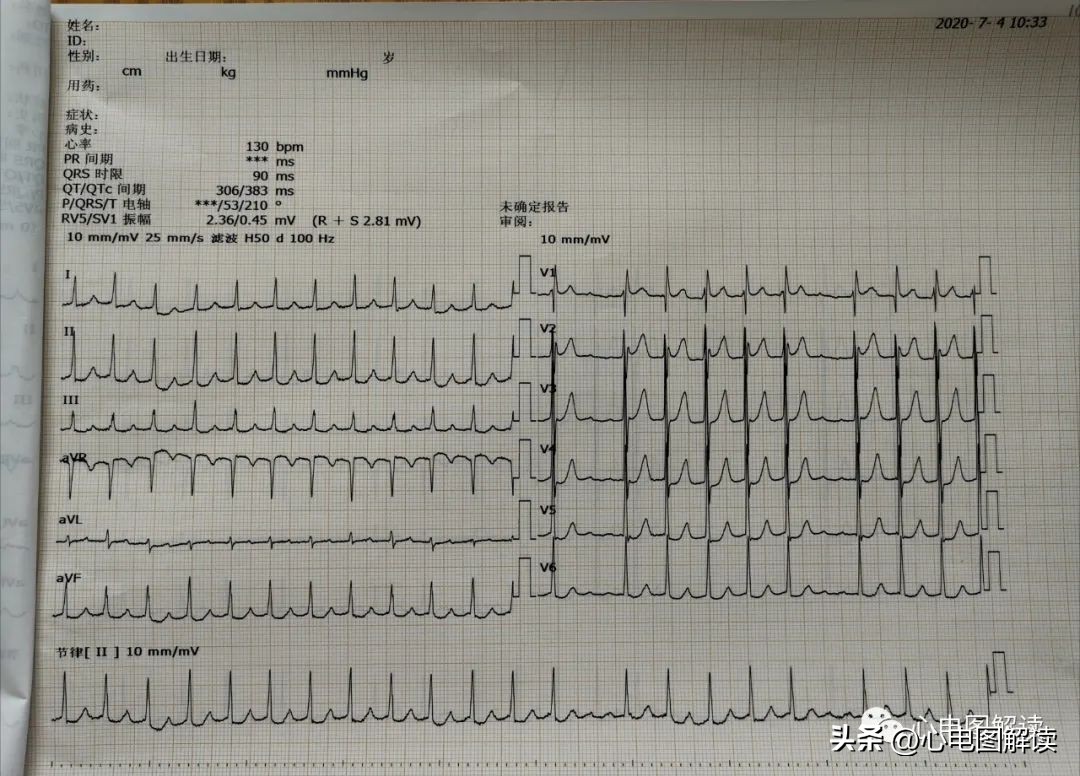 得来不易歌曲视频,得来不易纯音乐