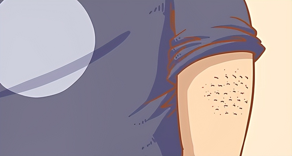 皮肤上长出肉疙瘩怎么办,皮肤上长肉疙瘩如何正确解决