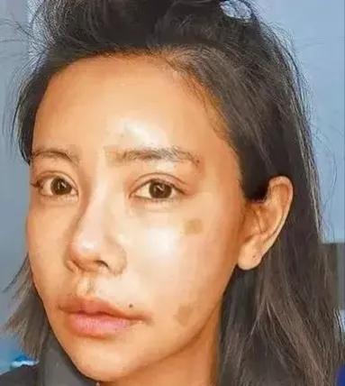 盘点那些整容整的最厉害的人,整容整的最厉害的三位女士