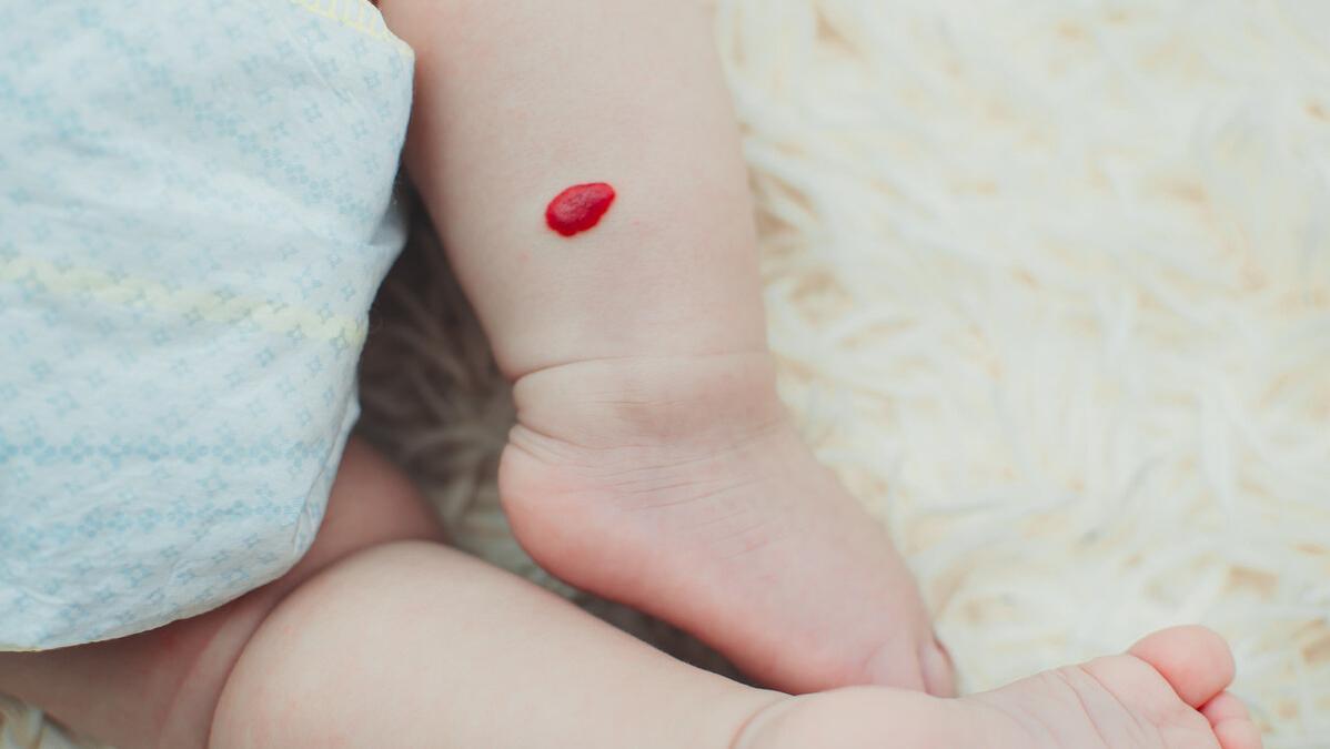 血管瘤要怎么治疗效果才最好,发现血管瘤怎么治疗好