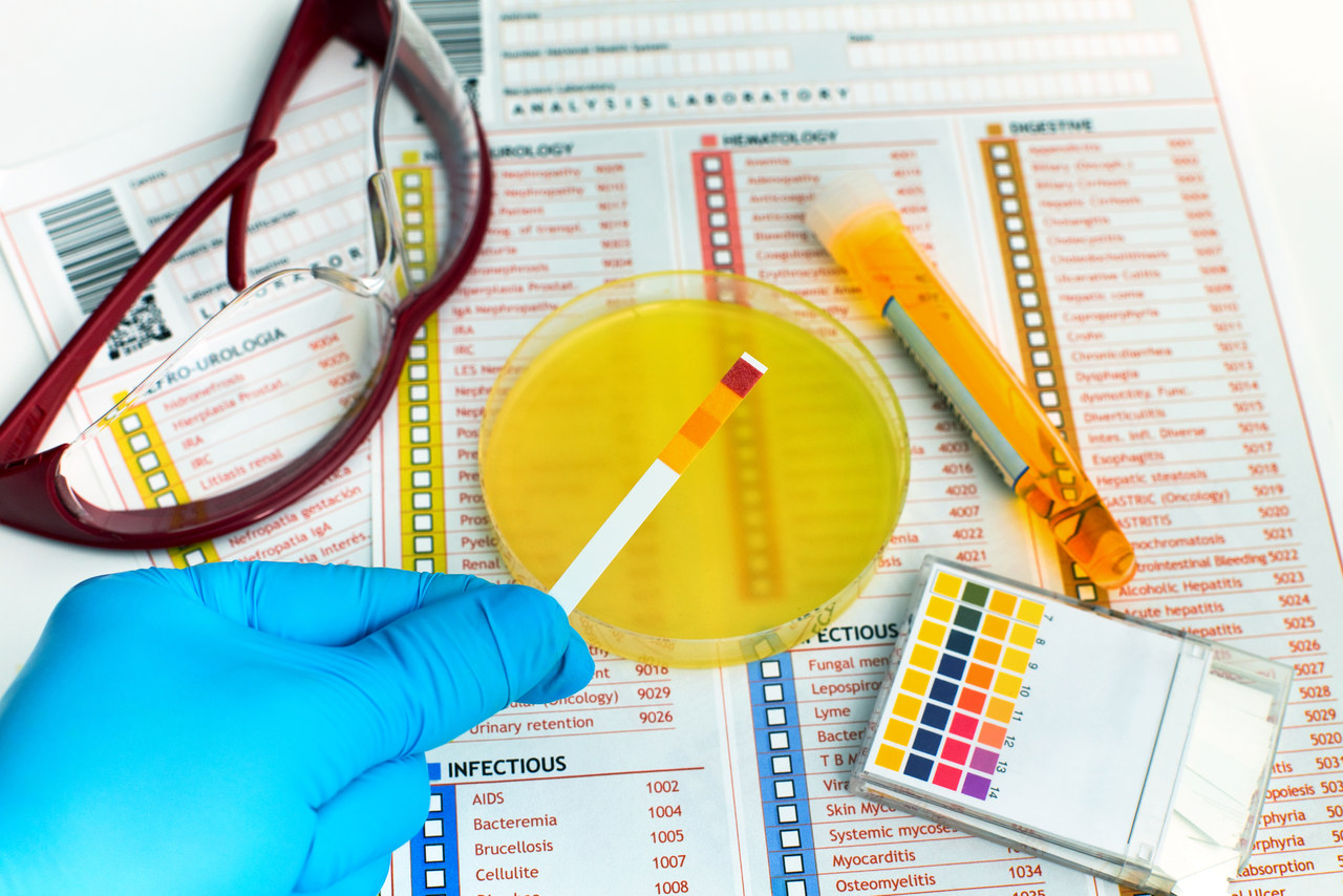 夜尿次数怎么计算,夜尿量多2-3次警惕三种病