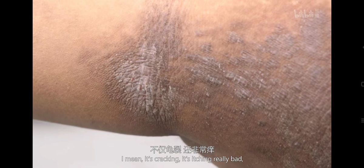 跟着皮肤科医生学英语