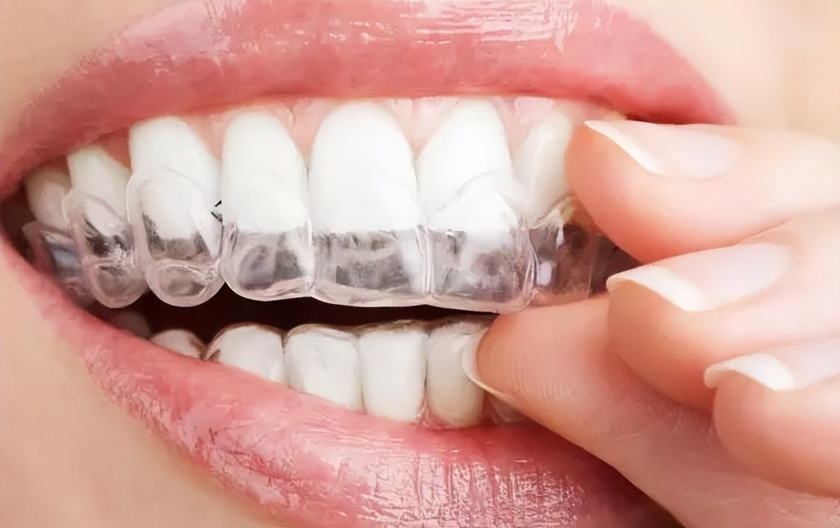 凸嘴形成的原因及凸嘴矫正方法,凸嘴如何改善