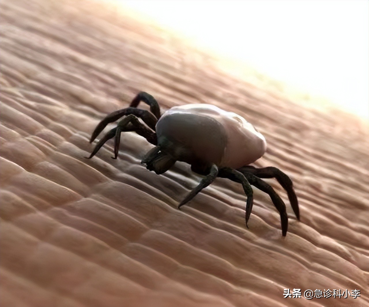 蜱虫咬人死亡率多少,蜱虫咬后死亡率新闻