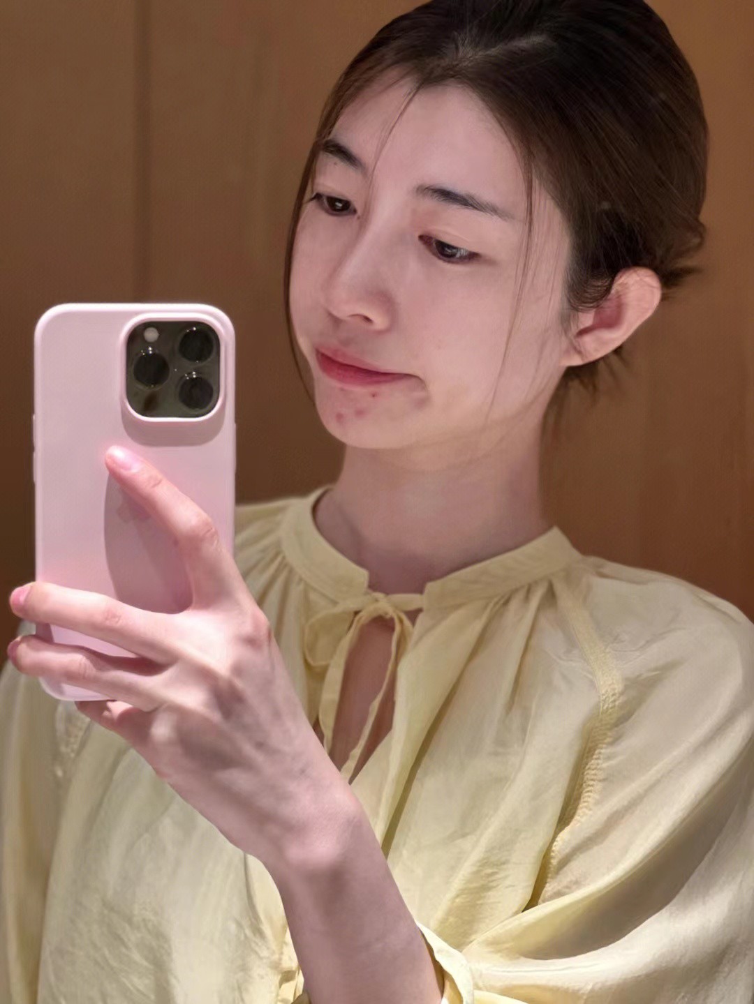 29岁脸上老是长痘痘是什么原因,脸上从来不长痘突然长痘怎么回事