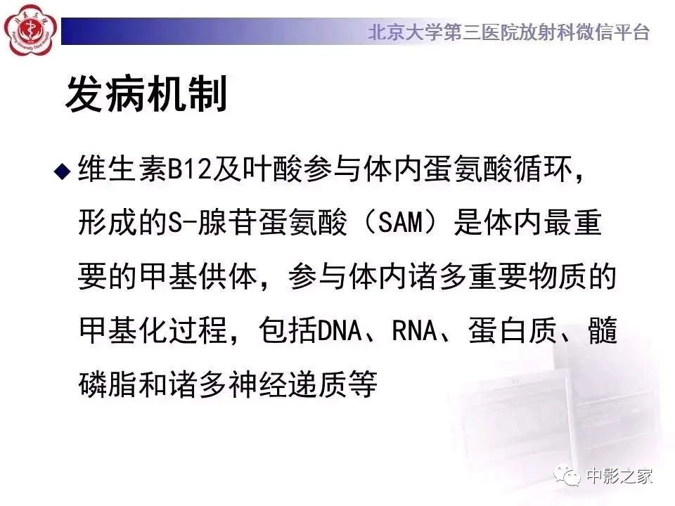 什么叫原发性胼胝体变性,原发性胼胝体变性治疗多少钱