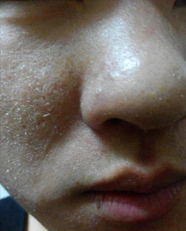 脸泛红是洗面奶的原因吗,为什么用完洗面奶脸会变白