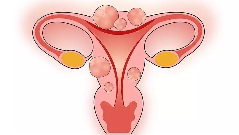 看不懂性激素六项检查报告单,性激素六项结果医生有没有不懂的
