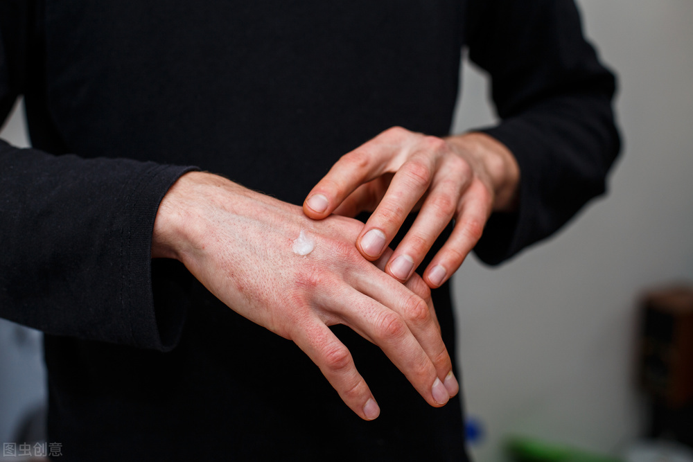 湿疹过敏引起皮肤发红怎么办,治疗湿疹过敏的药有哪些