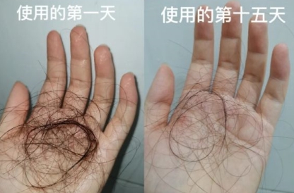 孕妇控油止痒去屑洗发水推荐,控油好的孕妇洗发水品牌