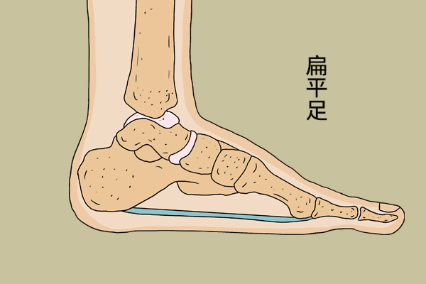 大腿膝盖外侧疼痛怎么办,大腿后侧疼痛怎么回事跑步