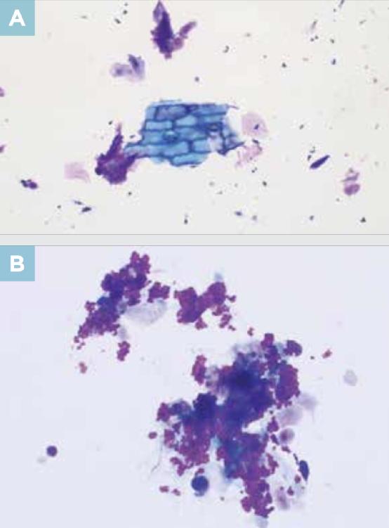 尿液干化学分析的实验原理,尿液标本采集操作