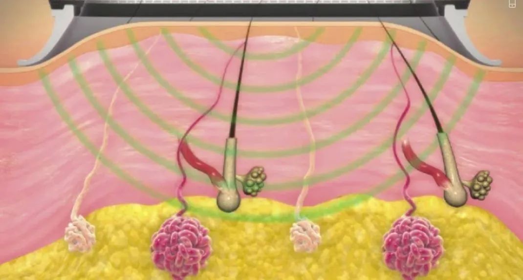 给夏天爱出汗的你：轻松止汗香汗指南