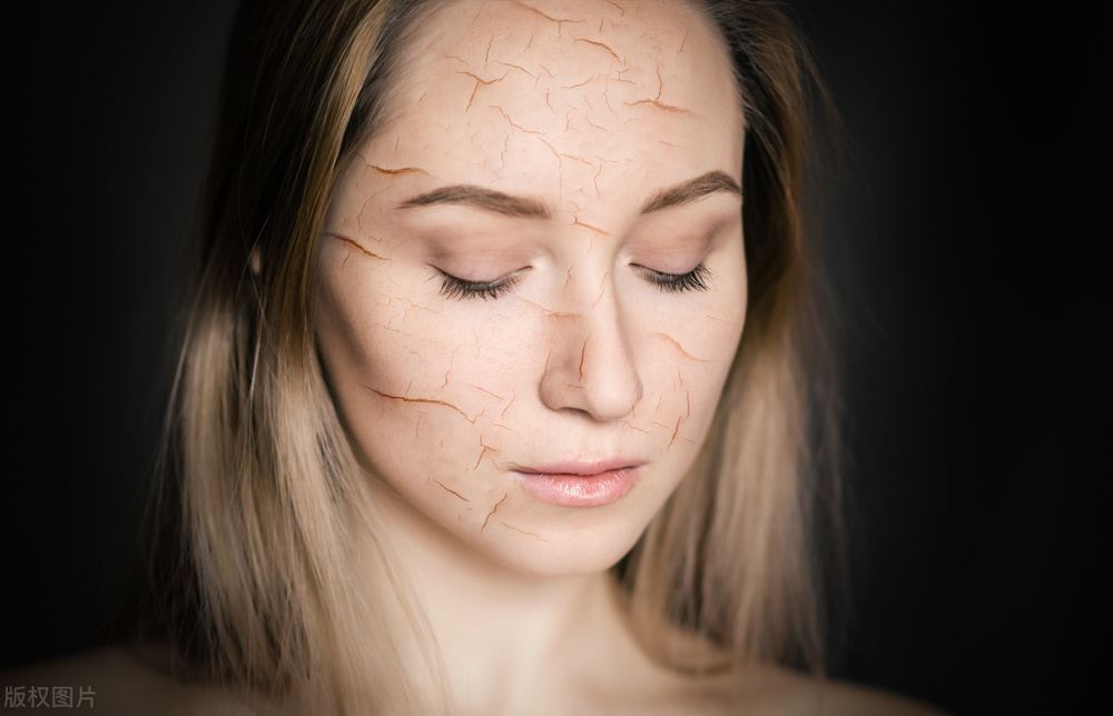 春季皮肤干燥脱皮是什么原因,冬季皮肤干燥起皮泛红刺痛怎么办