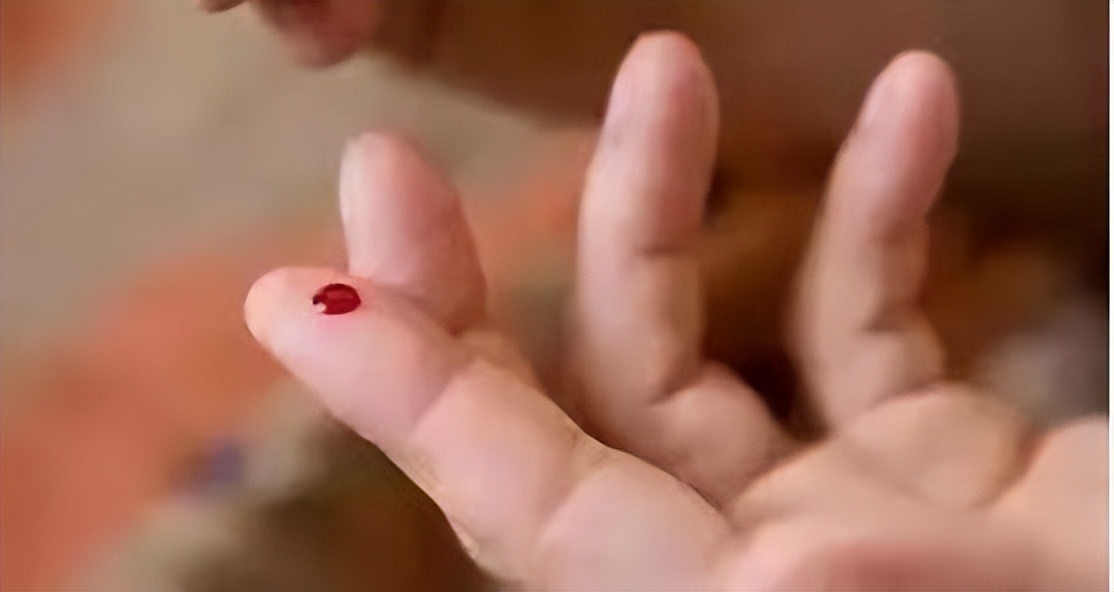 心梗猝死可自救扎针放血,急性心梗手指尖放血有道理吗