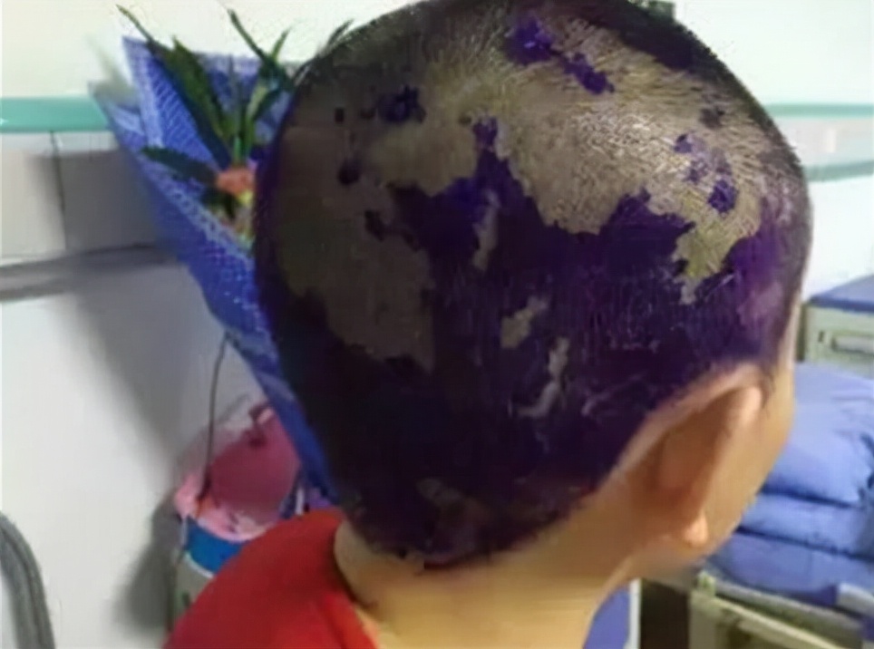 这些生发误区你还在做吗,这些防脱发产品你值得拥有